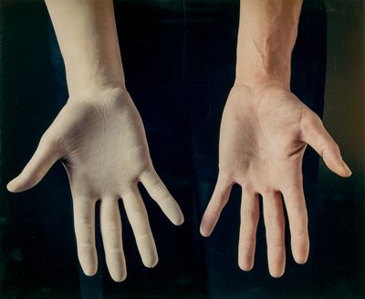 Giuseppe Penone, Guanto (Glove), 1972